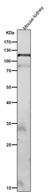 Anti-Phospho-FAK (Y576 + Y577) Rabbit Monoclonal Antibody Boster Bio
