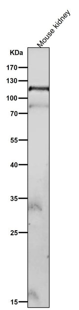 Anti-Phospho-FAK (Y576 + Y577) Rabbit Monoclonal Antibody Boster Bio