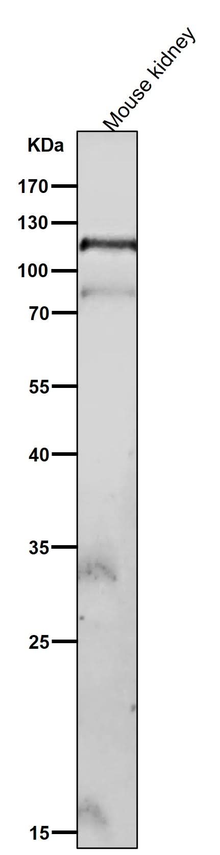 Anti-Phospho-FAK (Y576 + Y577) Rabbit Monoclonal Antibody Boster Bio