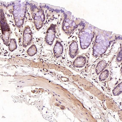 Anti-CD19 Rabbit Monoclonal Antibody Boster Bio