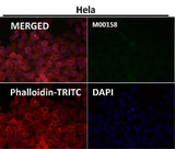 Anti-CCR2/CKR2 Rabbit Monoclonal Antibody Boster Bio