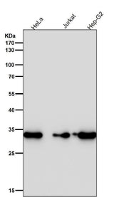 Anti-CDK4 Rabbit Monoclonal Antibody Boster Bio