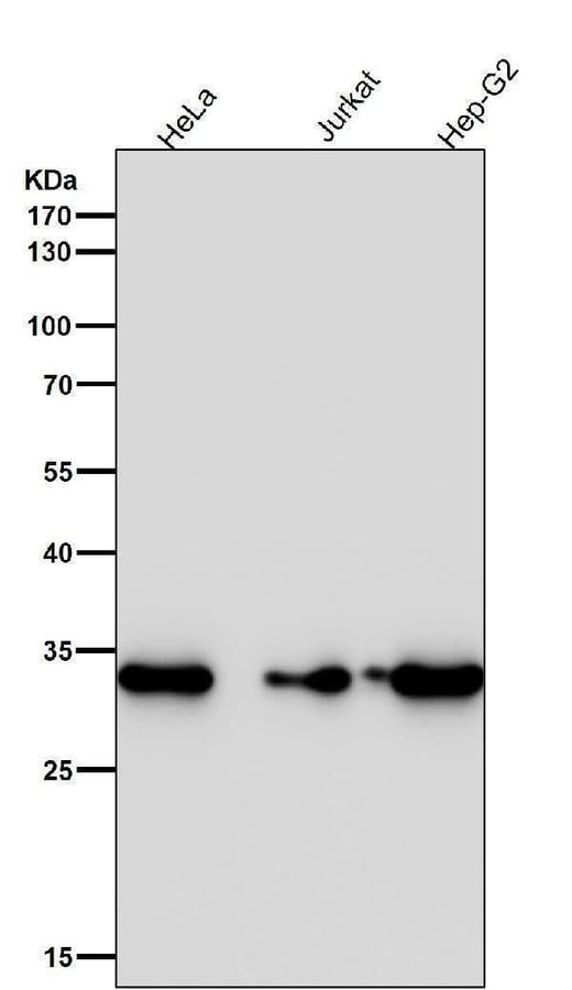 Anti-CDK4 Rabbit Monoclonal Antibody Boster Bio