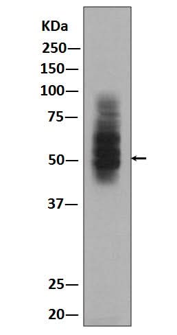 Anti-GLUT1 SLC2A1 Rabbit Monoclonal Antibody Boster Bio