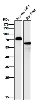 Anti-p63 TP63 Rabbit Monoclonal Antibody Boster Bio