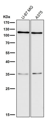 Anti-C3/Complement C3 Rabbit Monoclonal Antibody Boster Bio