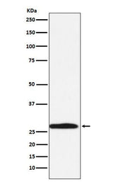 Anti-Carbonic Anhydrase 1 Rabbit Monoclonal Antibody Boster Bio