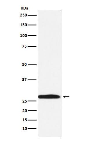 Anti-Carbonic Anhydrase 1 Rabbit Monoclonal Antibody Boster Bio