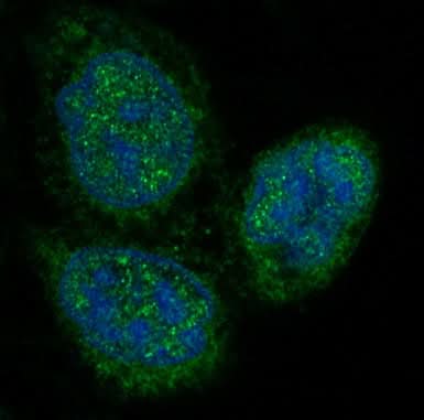 Anti-p27 KIP 1 CDKN1B Rabbit Monoclonal Antibody Boster Bio