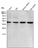 Anti-p38 MAPK14 Rabbit Monoclonal Antibody Boster Bio