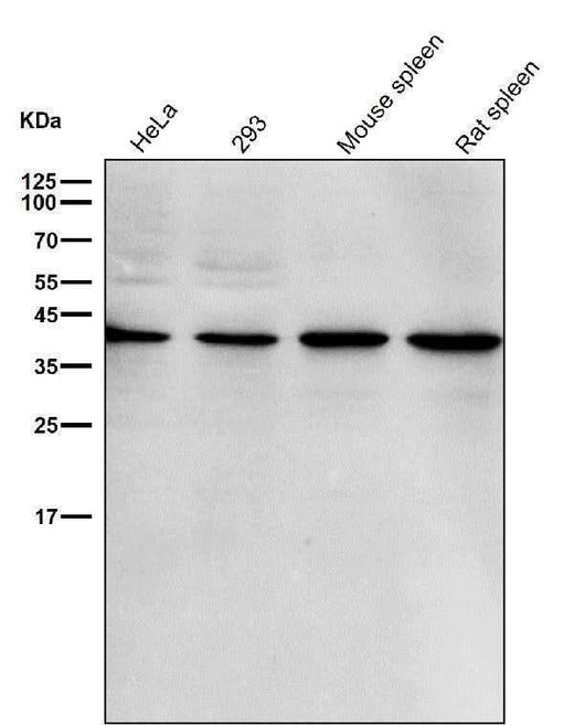 Anti-p38 MAPK14 Rabbit Monoclonal Antibody Boster Bio