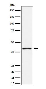 Anti-Phospho-p38 (T180) Rabbit Monoclonal Antibody Boster Bio