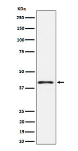 Anti-Phospho-p38 (T180) Rabbit Monoclonal Antibody Boster Bio