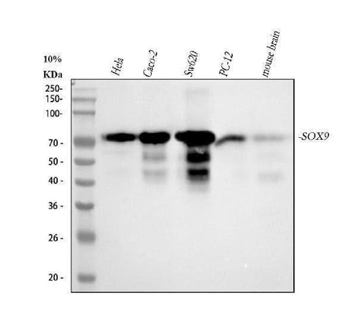 Anti-SOX9 Rabbit Monoclonal Antibody Boster Bio