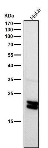 Anti-Caveolin-1 CAV1 Rabbit Monoclonal Antibody Boster Bio
