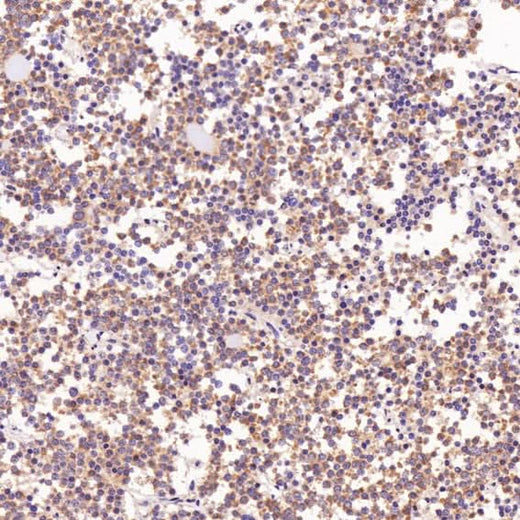 Anti-Bcl-XL BCL2L1 Rabbit Monoclonal Antibody Boster Bio