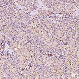 Anti-Bax Rabbit Monoclonal Antibody Boster Bio