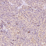 Anti-Bax Rabbit Monoclonal Antibody Boster Bio
