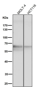 Anti-TRAF6 Rabbit Monoclonal Antibody Boster Bio