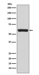 Anti-TRAF6 Rabbit Monoclonal Antibody Boster Bio