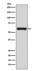 Anti-TRAF6 Rabbit Monoclonal Antibody Boster Bio