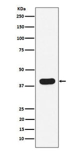 Anti-HLA B7 Rabbit Monoclonal Antibody Boster Bio