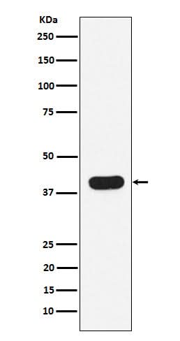 Anti-HLA B7 Rabbit Monoclonal Antibody Boster Bio
