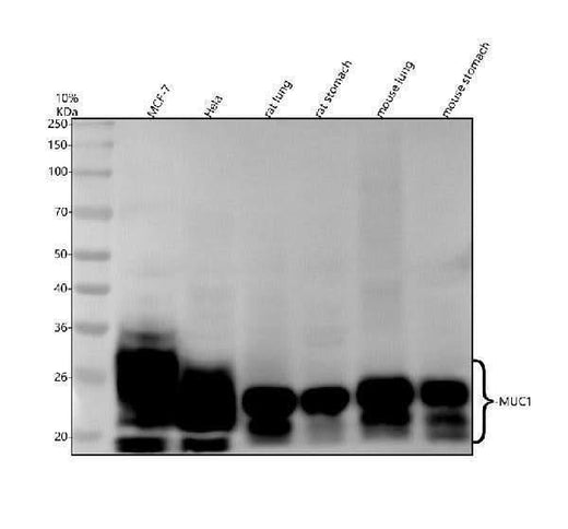 Anti-MUC1 Rabbit Monoclonal Antibody Boster Bio