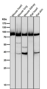 Anti-Argonaute 2 AGO2 Rabbit Monoclonal Antibody Boster Bio