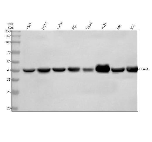 Anti-MHC class 1 HLA-A Rabbit Monoclonal Antibody Boster Bio