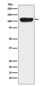 Anti-ITCH Monoclonal Antibody Boster Bio