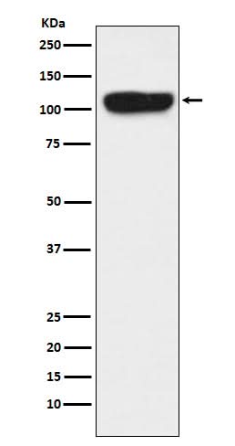 Anti-ITCH Monoclonal Antibody Boster Bio