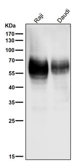 Anti-CD80/B7 1 Rabbit Monoclonal Antibody Boster Bio