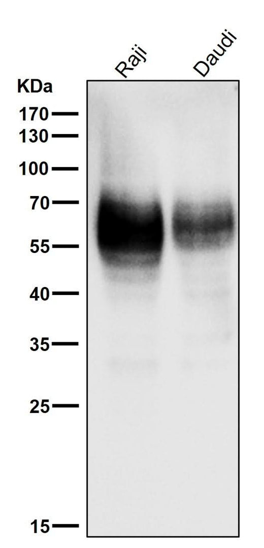 Anti-CD80/B7 1 Rabbit Monoclonal Antibody Boster Bio
