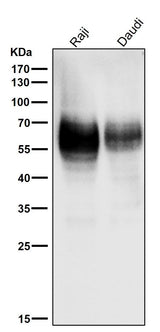 Anti-CD80/B7 1 Rabbit Monoclonal Antibody Boster Bio