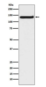 Anti-TLR9 Rabbit Monoclonal Antibody Boster Bio