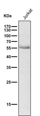 Anti-Wilms Tumor Protein WT1 Rabbit Monoclonal Antibody Boster Bio