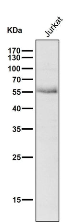 Anti-Wilms Tumor Protein WT1 Rabbit Monoclonal Antibody Boster Bio