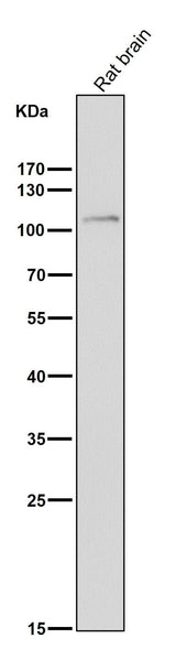 Anti-FGFR3 Rabbit Monoclonal Antibody Boster Bio