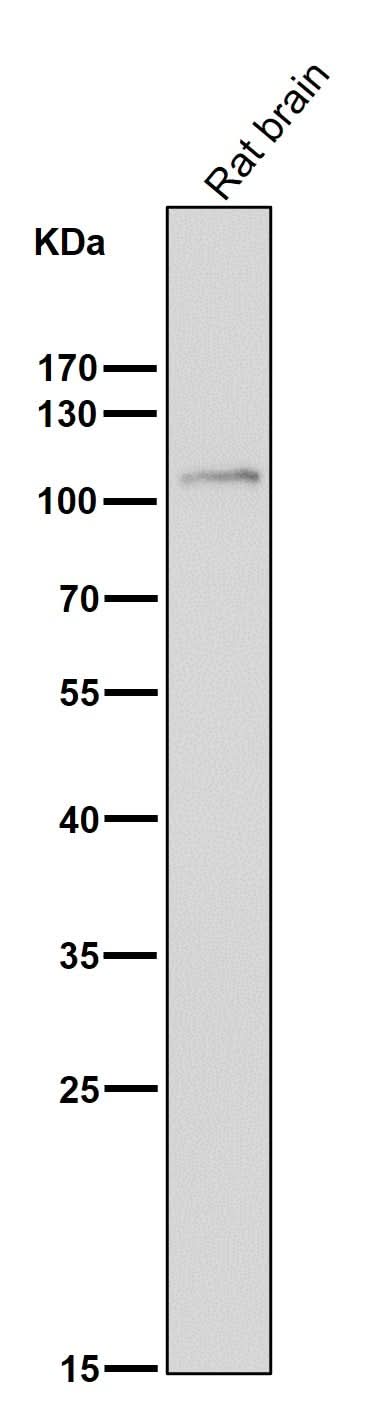 Anti-FGFR3 Rabbit Monoclonal Antibody Boster Bio