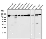 Anti-FGFR3 Rabbit Monoclonal Antibody Boster Bio