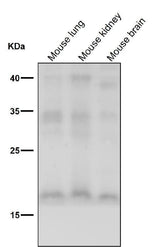 Anti-FGF1 Rabbit Monoclonal Antibody Boster Bio