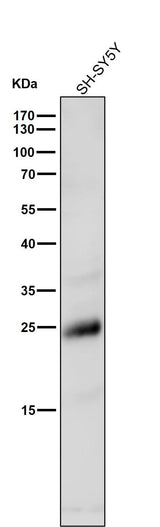 Anti-Rho RHOA Rabbit Monoclonal Antibody Boster Bio
