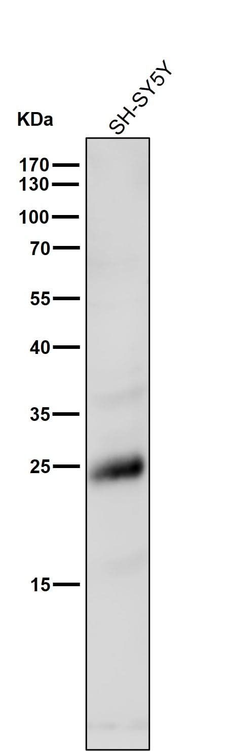 Anti-Rho RHOA Rabbit Monoclonal Antibody Boster Bio