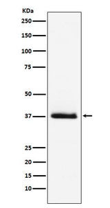 Anti-Parathyroid Hormone Rabbit Monoclonal Antibody Boster Bio