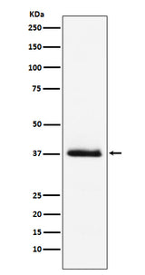 Anti-Parathyroid Hormone Rabbit Monoclonal Antibody Boster Bio