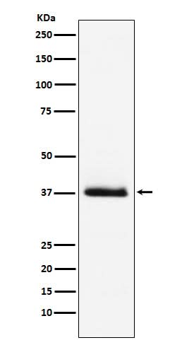 Anti-Parathyroid Hormone Rabbit Monoclonal Antibody Boster Bio
