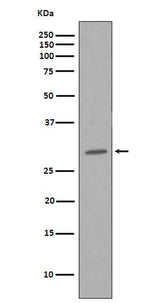 Anti-CDK1/Cdc2 Rabbit Monoclonal Antibody Boster Bio
