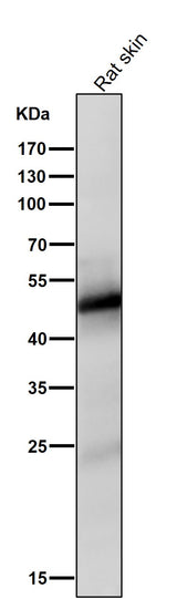 Anti-Vitamin D Receptor VDR Rabbit Monoclonal Antibody Boster Bio
