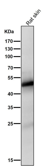 Anti-Vitamin D Receptor VDR Rabbit Monoclonal Antibody Boster Bio